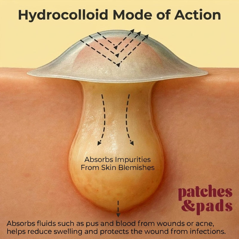 Patches and Pads Pimple Patches Underground