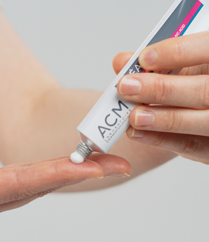 Acm Azeane 15% Azelaic Acid Cream, gezichtscrème met azelaïnezuur tegen pigmentvlekken en onzuiverheden