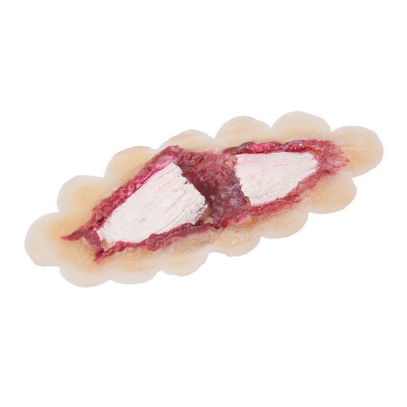 Grimas Latex Protheses Bone Fracture 810 1