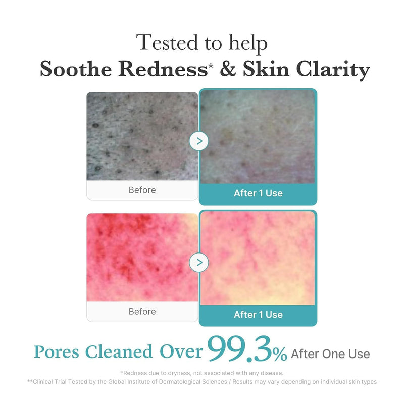 Medicube Azelaic ACID Niacinamide DEEP Clean FOAM Cleanser, gezichtsreiniger voor de vette en onzuivere huid