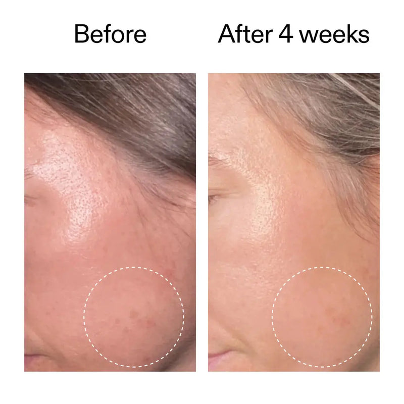 The Inkey List Advanced Retinoid Serum